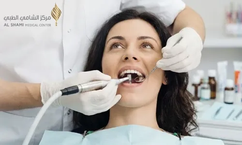 Teeth Scaling & Polishing at Al Shami Medical Center!