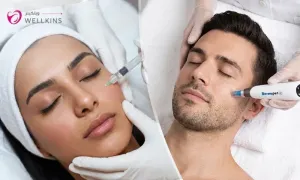 wellkins_dealimage_beautyspa_mesotherapy-copy.webp