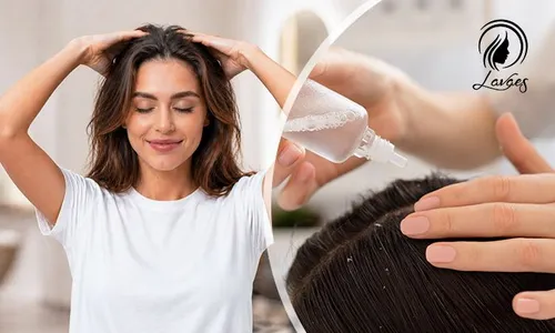 Anti-Dandruff Hair Treatment for Ladies!