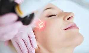 al-aqsa-_deal-image_healthn-clinic-_microneedle-2-copy.jpg