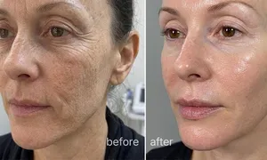 cuban-beauty_dealimage_beautyspa_facials--3copy.jpg