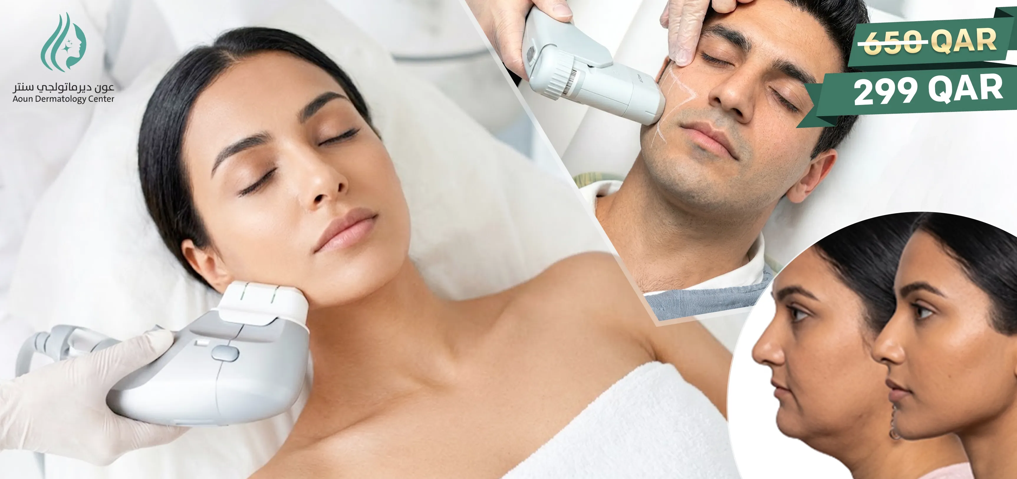 HIFU Skin Tightening for Ladies & Men