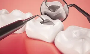 dafna-medical_-dealimage_health_scaling-teeth-4-copy.jpg