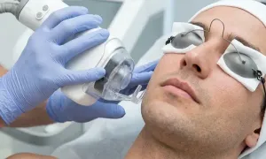 dafna-medical_-dealimage_health_fractional-laser-1-copy.webp