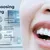 dr-walid-_deal-image_health-clinic-_teeth-scaling-polish-4-copy.jpg