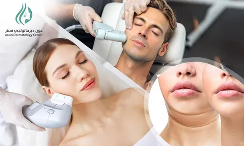 HIFU Skin Tightening for Ladies & Men at Aoun Dermatology Center!