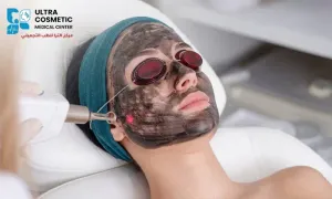 ultra-cosmetic-medical-center_-dealimage_health_carbon-laser-1copy.webp