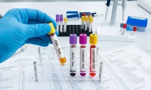 -al-hilal-premium-medical-center_dealimage_health-clinic_dental-health-tests-copy.webp