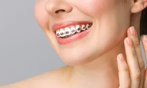 tadawi_dealimage_health-clinic_braces-2copy.jpg