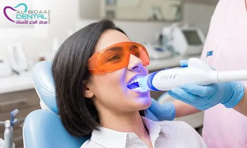 Zoom Teeth Whitening & Consultation at Al Bidaa Dental!