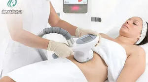 Vela Shape by Aoun Dermatology: Non-Surgical Slimming & Fat Reduction!