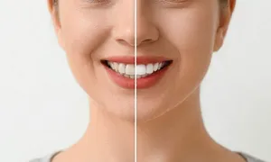 dr-walid-_deal-image_health-clinic-_teeth-scaling-polish-1-copy.jpg