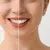 dr-walid-_deal-image_health-clinic-_teeth-scaling-polish-1-copy.jpg