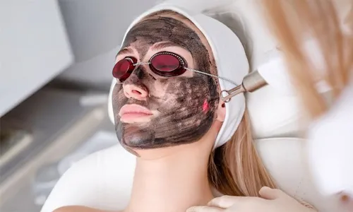 Carbon Laser & Hair Bleaching for Ladies & Men at Nesma Medical Center!
