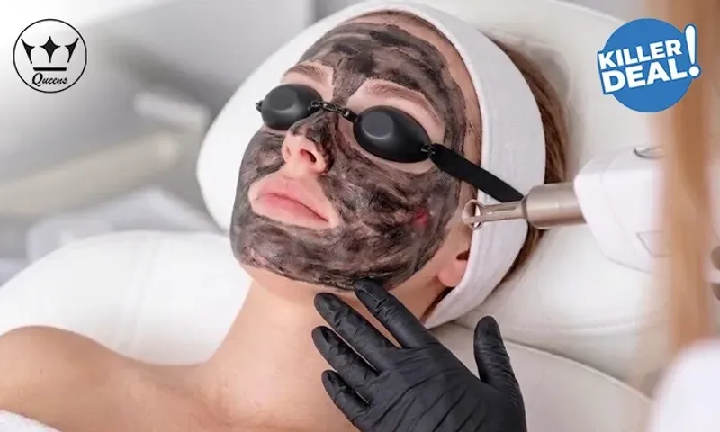 Killer Deal Alert! Carbon Laser Treatment & Skin Lightening for Ladies & Men at Queens Dermatology Center!