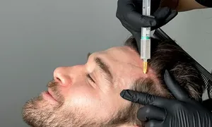 queens-derma_-dealimage_healthandclinic_prp-hair-2__02.jpg