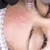 austin-medical-dealimage_health-clinic-_microneedling-prp-2.jpg