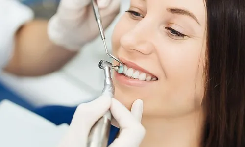Teeth Scaling & Polishing + Consultation!