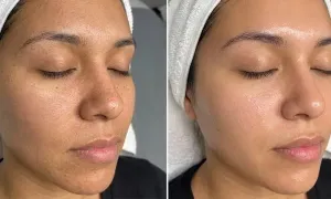 fatati_dealimage_beautyspa_diamond-peel-2-copy.webp
