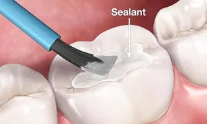 pioneer_dealimage_health-clinic-_-teeth-3-copy.jpg