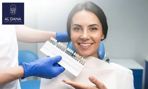 Dental Care: Veneers, Fillings & Consultation at Al Dana Dental Center!
