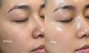 austin-medical-dealimage_health-clinic-_-facial-2-copy.jpg