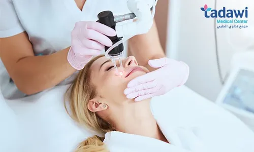 Glow & Renew with Spectra Bleaching, Carbon Laser at Tadawi Medical Center!