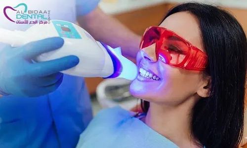 Zoom Teeth Whitening & Consultation at Al Bidaa Dental!