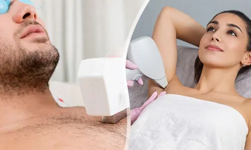 Laser Hair Removal for Ladies & Gents at Al Dafna Medical Center!