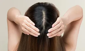 queens-derma_-dealimage_healthandclinic_prp-hair4.jpg