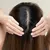 queens-derma_-dealimage_healthandclinic_prp-hair4.jpg