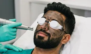 dafna-medical_-dealimage_health_carbon-laser1.jpg