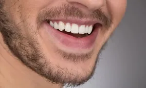 alpha-dental_-dealimage_health_flash-teeth-3-copy.jpg
