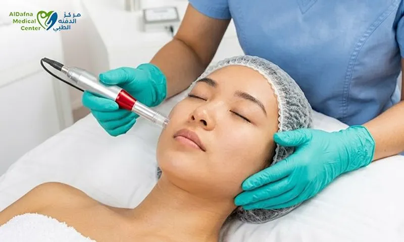 Dermapen, Mesotherapy & PRP for Ladies & Men at Al Dafna Medical Center!