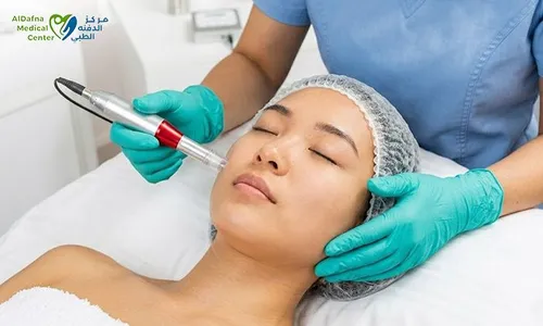 Dermapen, Mesotherapy & PRP for Ladies & Men at Al Dafna Medical Center!