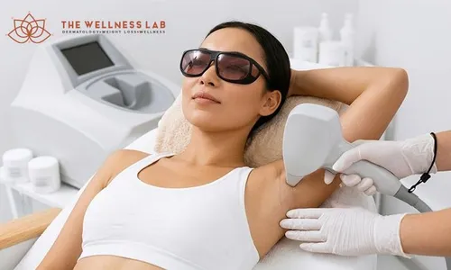 Laser Hair Removal for Women & Men at The Wellness Lab!