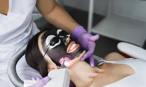 queens-derma_-dealimage_healthandclinic_carbon-laser1-copy.jpg
