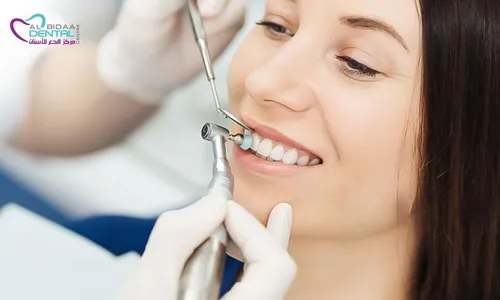 Teeth Scaling & Polishing + Consultation at Al Bidaa Dental!