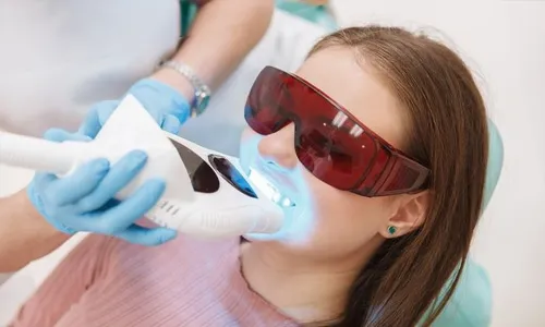 Teeth Whitening & Consultation at Reem Medical Center!