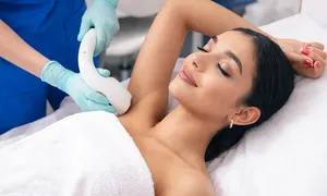 tadawi_laser-hair-removal-dealimage-02.jpg
