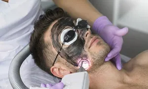 tadawi_dealimage_health-clinic_carbon-laser-2-copy.jpg