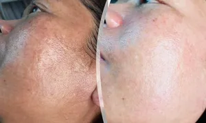 lavaes-beauty_deal-image_beauty-spa-_hydrafacial-2-copy.jpg