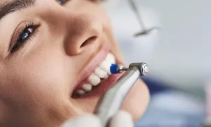 dr-walid-_deal-image_health-clinic-_dental-cleaning-2-copy.jpg