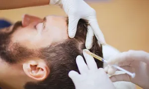 queens-derma_-dealimage_healthandclinic_full-hair-2-copy.jpg