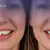 al-dana-dealimage_health-clinic-_-veneer-3filling.jpg