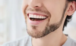 al-kindi-clinic_dealimage_health-clinic-_zoom-teeth-7-copy.jpg