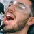 _al-hilal-premium-medical-center_dealimage_health-clinic_dental-scaling-1-.jpg