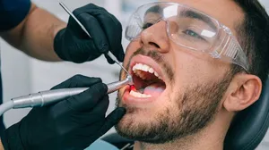_al-hilal-premium-medical-center_dealimage_health-clinic_dental-scaling-1-.jpg