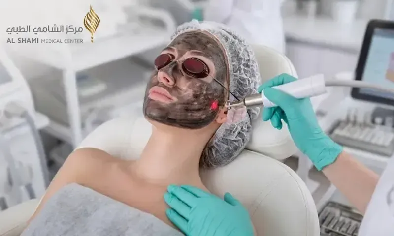 Carbon Laser Skin Rejuvenation & Brightening Treatment for Ladies & Gents!