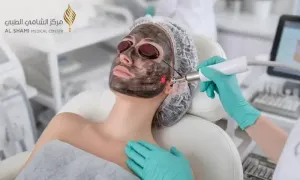 al-shami-medical-center_dealimage_health-and-clinic_carbon-laser-copy__02.webp